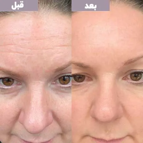 رتینول چیست؟ معجزه جوانسازی پوست + روش استفاده درست